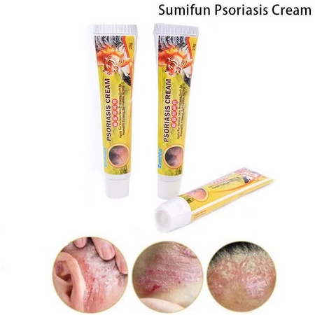 Salep Gatal Psoriasis Ampuh Mengatasi Psoriasis,Eksim, Kemerahan, Peradangan dan Iritasi oleh Jamur