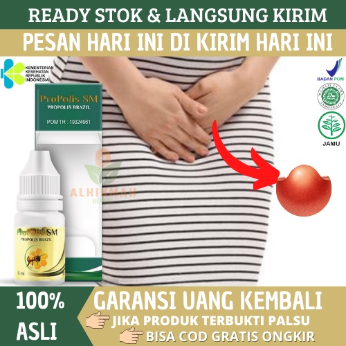 Obat Bisul Di Kemaluan, Pengempis Bisul Di Kelamin, Obat Bisul Di Bibir Miss V Dan Bisul Di Selangka