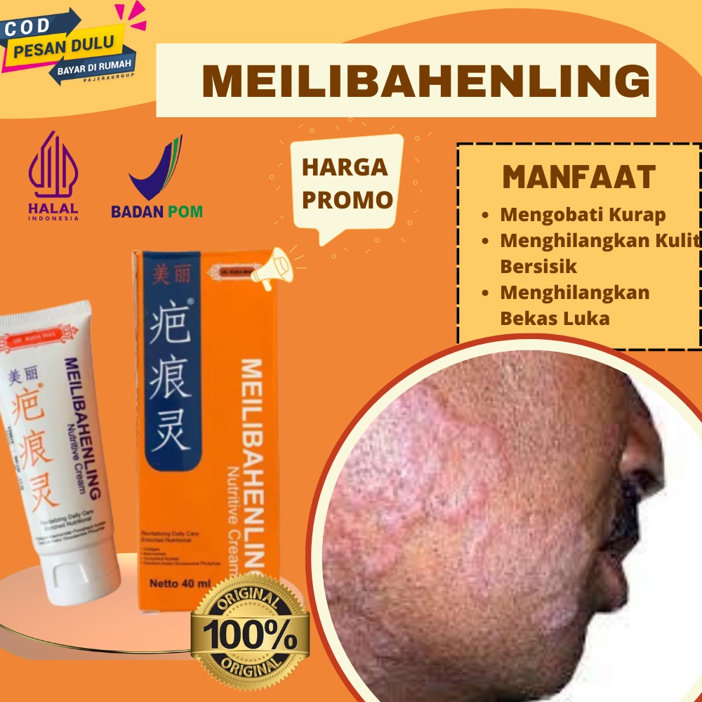 PALING AMPUH ! Salep Herbal  Menghilangkan Kurap, Kudis, Panu, Kadas, Salep Penghilang Sakit Gatal K