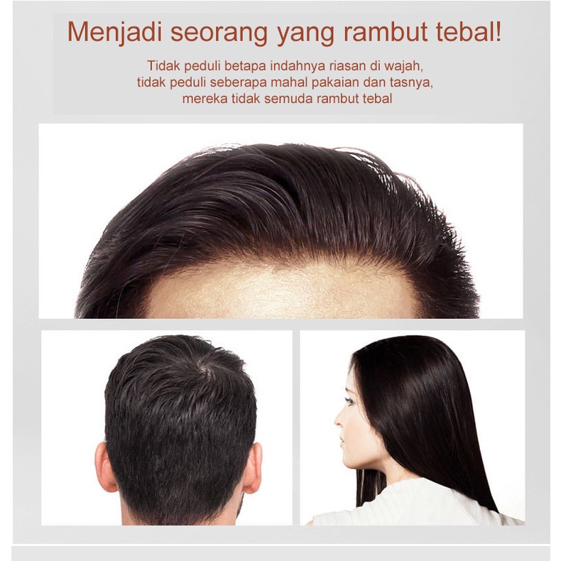 Ginge Esensi Ginger Hair Growth Essence Hair Treatment Serum 30ml Hair Oil Serum Rambut Anti Rontok Mempercepat Pertumbuhan Rambut Botak Khusus untuk rambut rontok