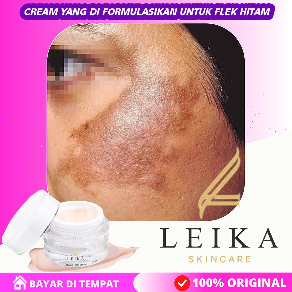 AMPUH PERMANEN  KRIM MALAM PERAWATAN WAJAH FLEK HITAM Cream penghilang flek hitam membandel yang amp