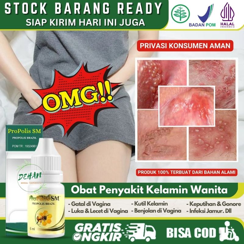 Salep Penghilang Gatal Bentol - Bentol di Bibir Vagina 100% Alami, Pengempis Benjolan di Vagina, Oba
