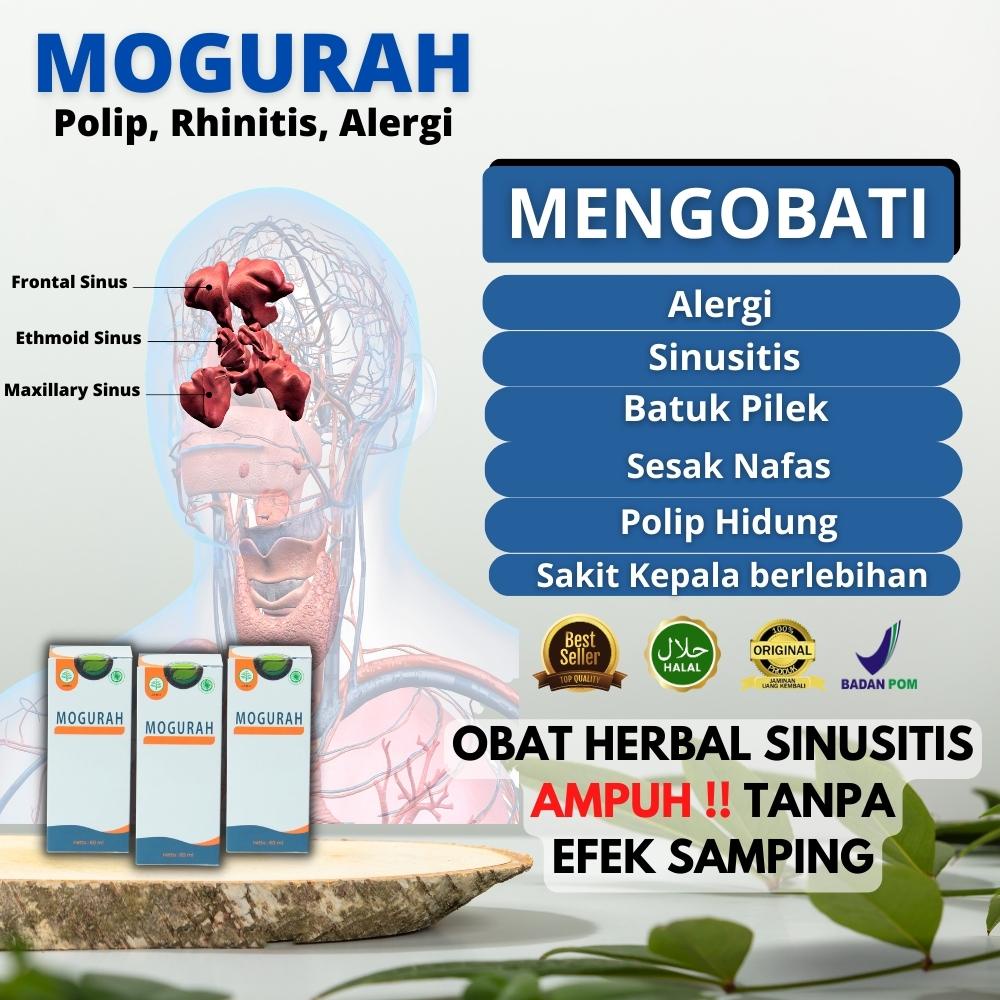 Mogurah Obat Sinusitis, Sinusitis Akut, Sinusitis Kronis, Sinusitis Menahun, Obat Sinusitis Herbal, 