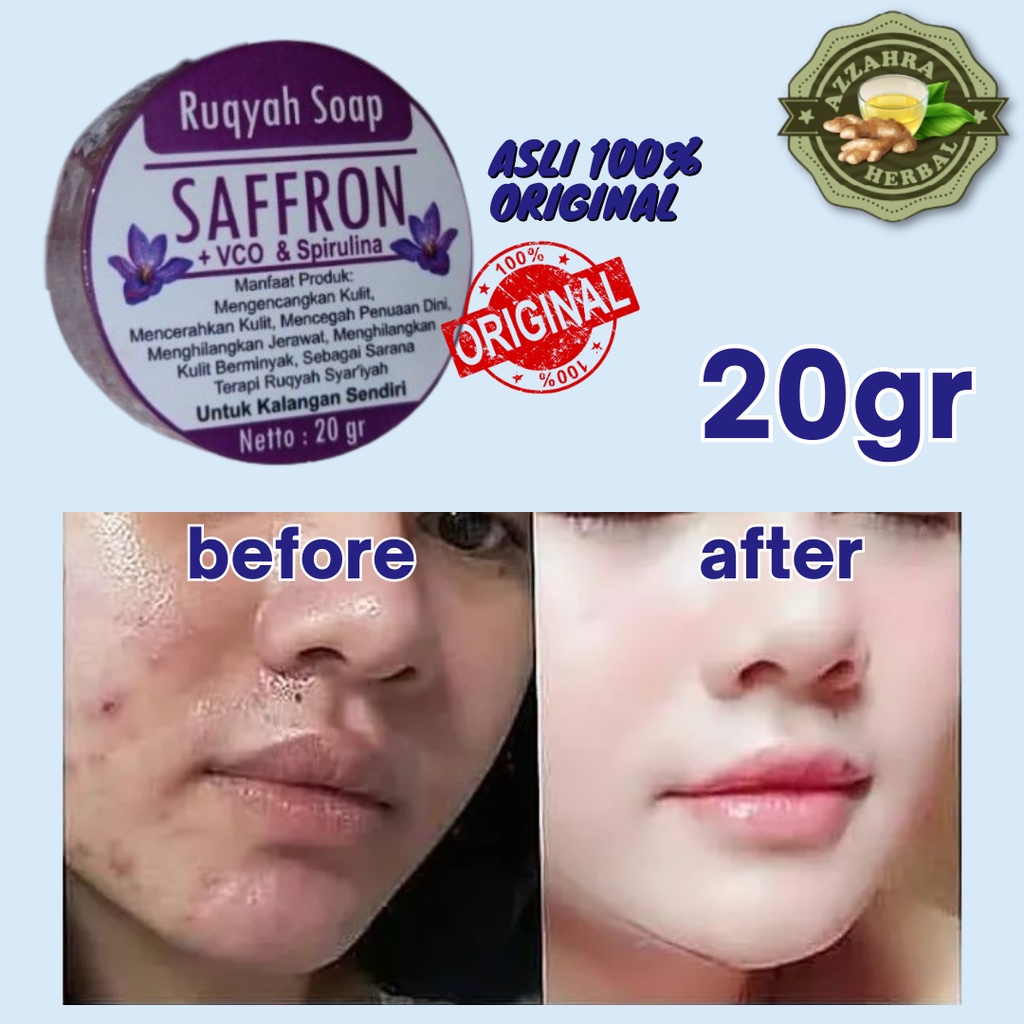 Sabun Saffron Penghilang Jerawat Pemutih Wajah Alami VCO Spirulina Scars Bekas Luka Noda Hitam