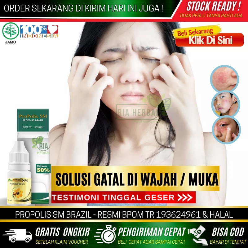 Obat Salep Iritasi Kulit Wajah, Obat Menghilangkan Gatal Bruntusan Di Wajah, Obat Muka Gatal Dan Pan