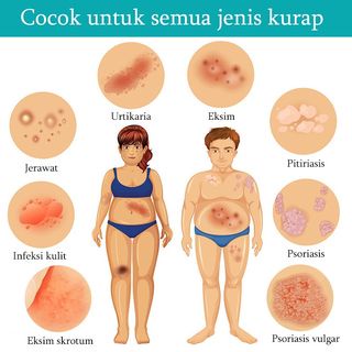 salep gatal salep eksim salep kulit 20g gatal ruam penyakit kulit kurap ekstrak ramuan air kutu Anti-kemerahan anti-gatal,pelembab, multifungsi, penghilang bekas luka.