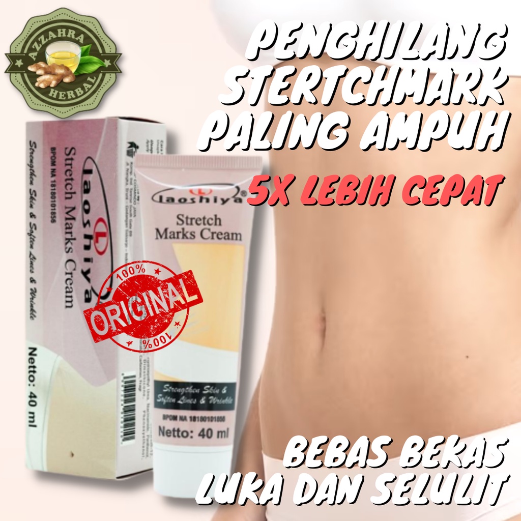 Laoshiya Stretch Mark Cream - Penghilang Strechmark Ampuh Permanen Bpom Stretchmark Stretch Mark Cream Krim Obat Salep