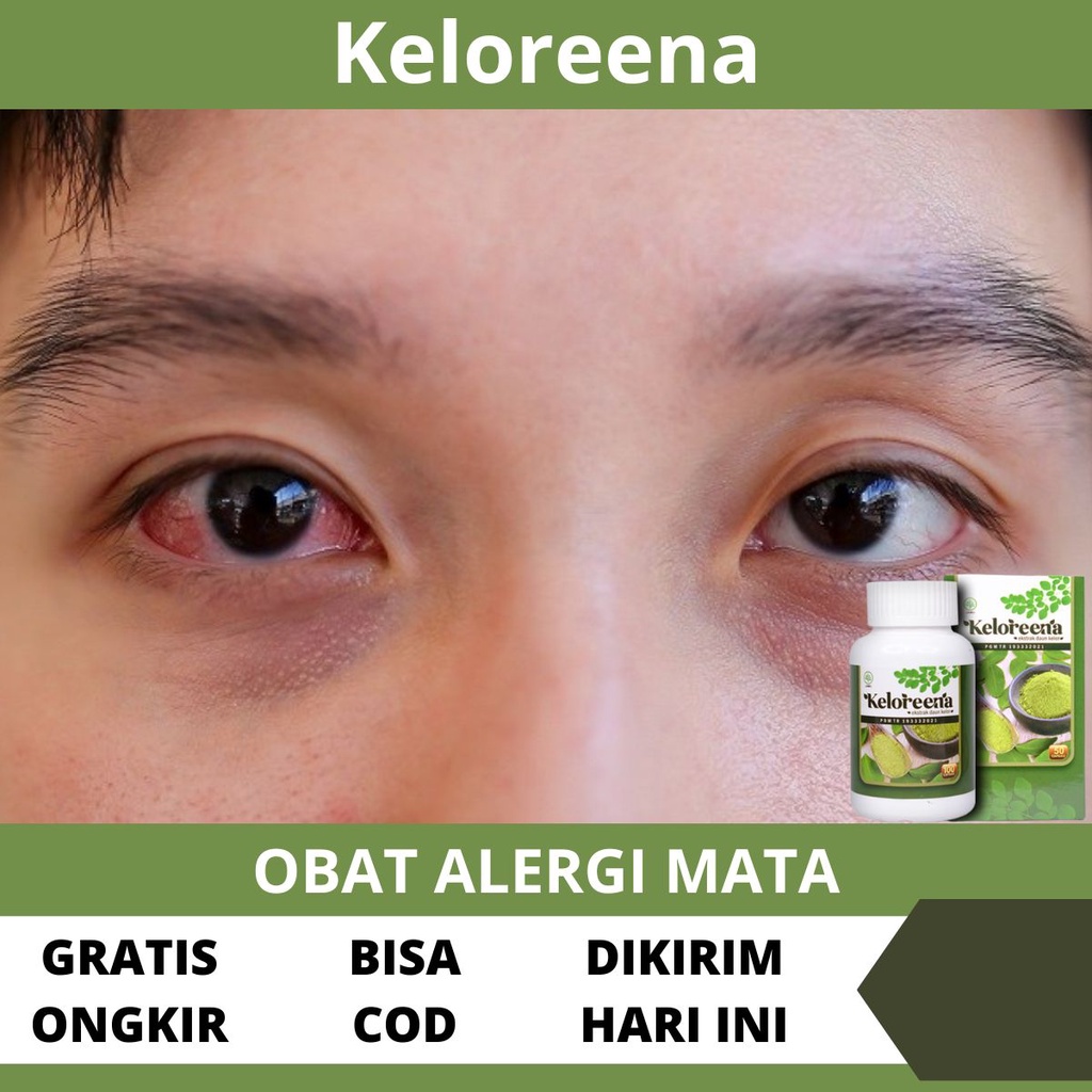 Obat Alergi Mata - Penghilang Alergi Mata Bengkak, Gatal, Merah, Bintitan, Berair, Perih, Pereda Pen