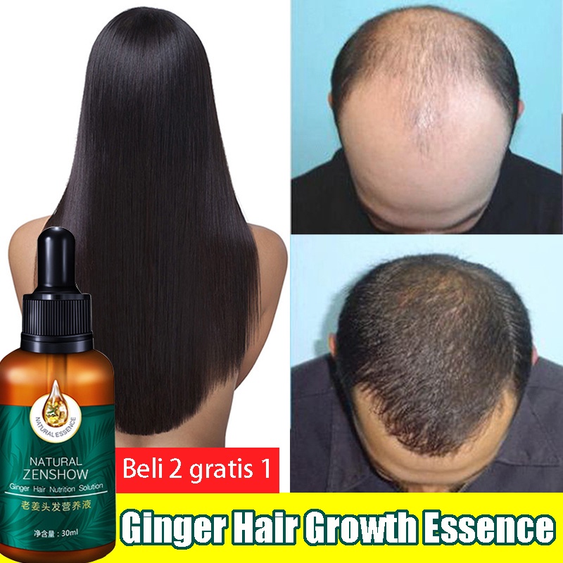 Ginge Esensi Ginger Hair Growth Essence Hair Treatment Serum 30ml Hair Oil Serum Rambut Anti Rontok Mempercepat Pertumbuhan Rambut Botak Khusus untuk rambut rontok