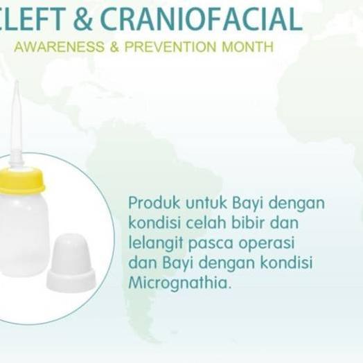 ℮ Botol Bibir Sumbing Pigeon Botol Pipet Bibir Sumbing Pigeon dot panjang bayi ℮