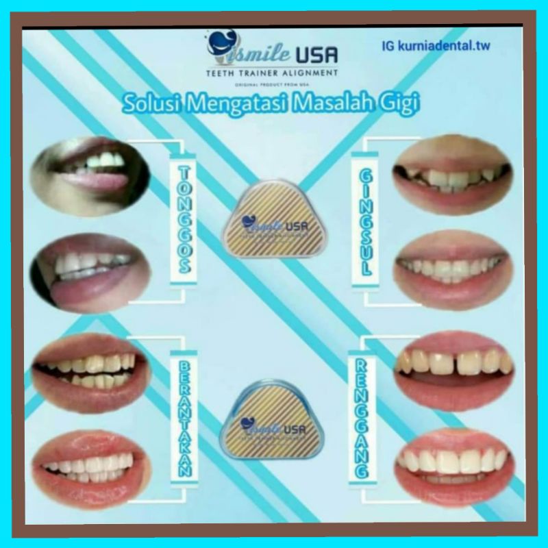 Jual perapih gigi original, perapih gigi ismile USA, teeth trainer ...