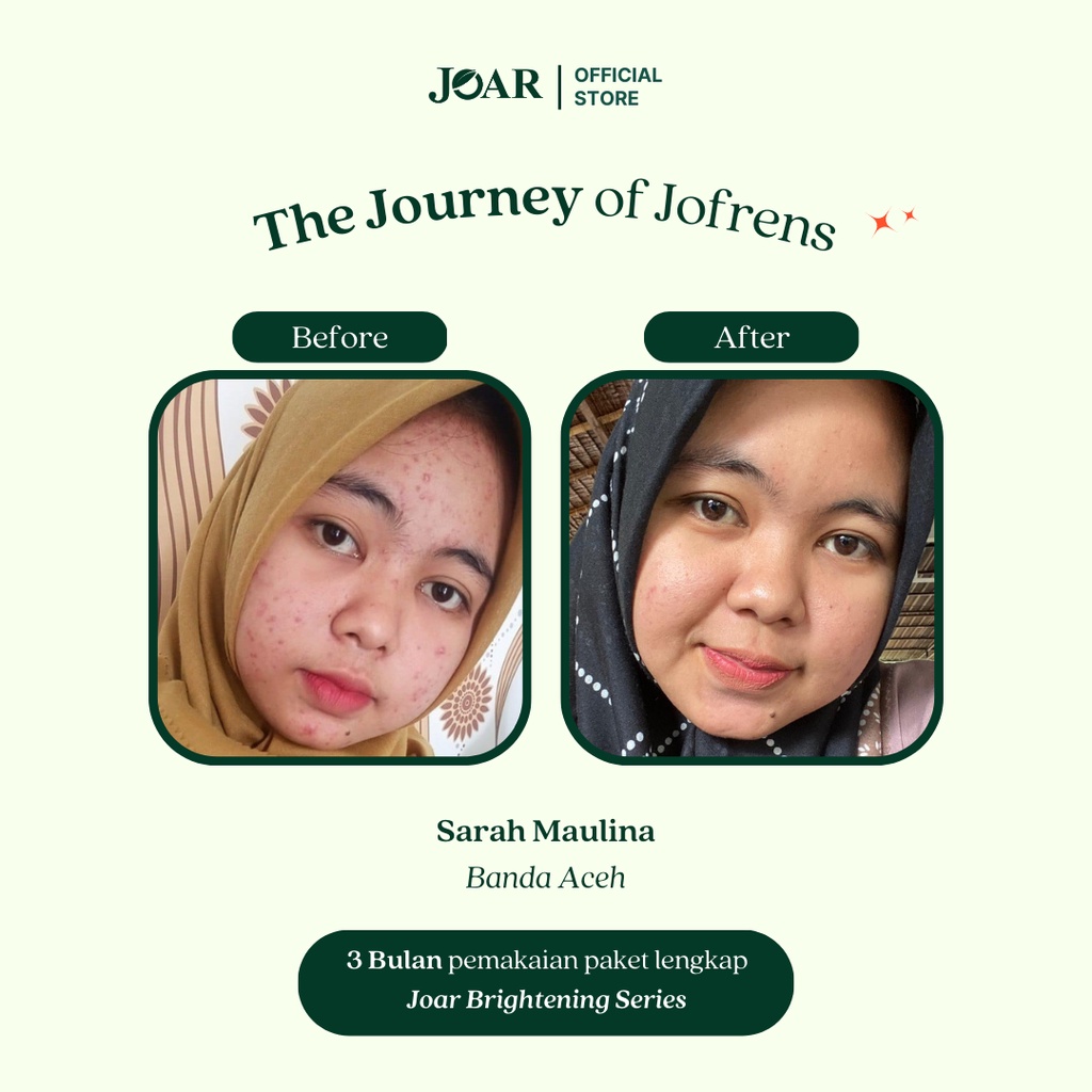 Joar Skincare [2 Pcs] Series Brightening (Soap Bar/Sabun, Serum, Day Cream, Night Cream &amp; Face mist)