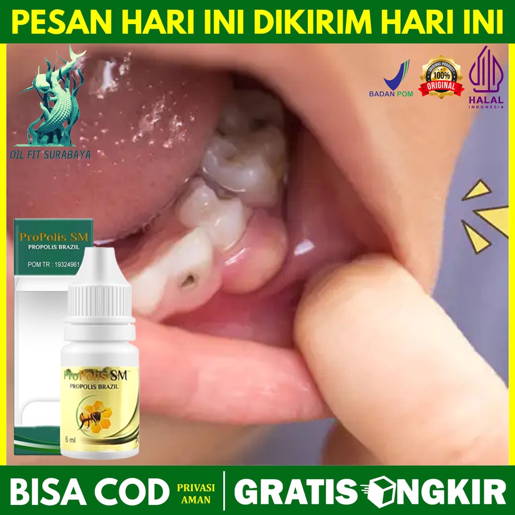 Cara Mengatasi Gusi Bengkak Gusi Bengkak Bernanah Gusi Bengkak Berdarah Gusi Bengkak Abses Gusi Beng