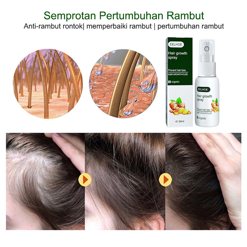 Ginge Esensi Semprotan jahe Ginger Hair Growth Essence 30ml Hair Oil Serum Rambut Anti Rontok Mempercepat Pertumbuhan Rambut Botak Rontok germinal rambut Perawatan