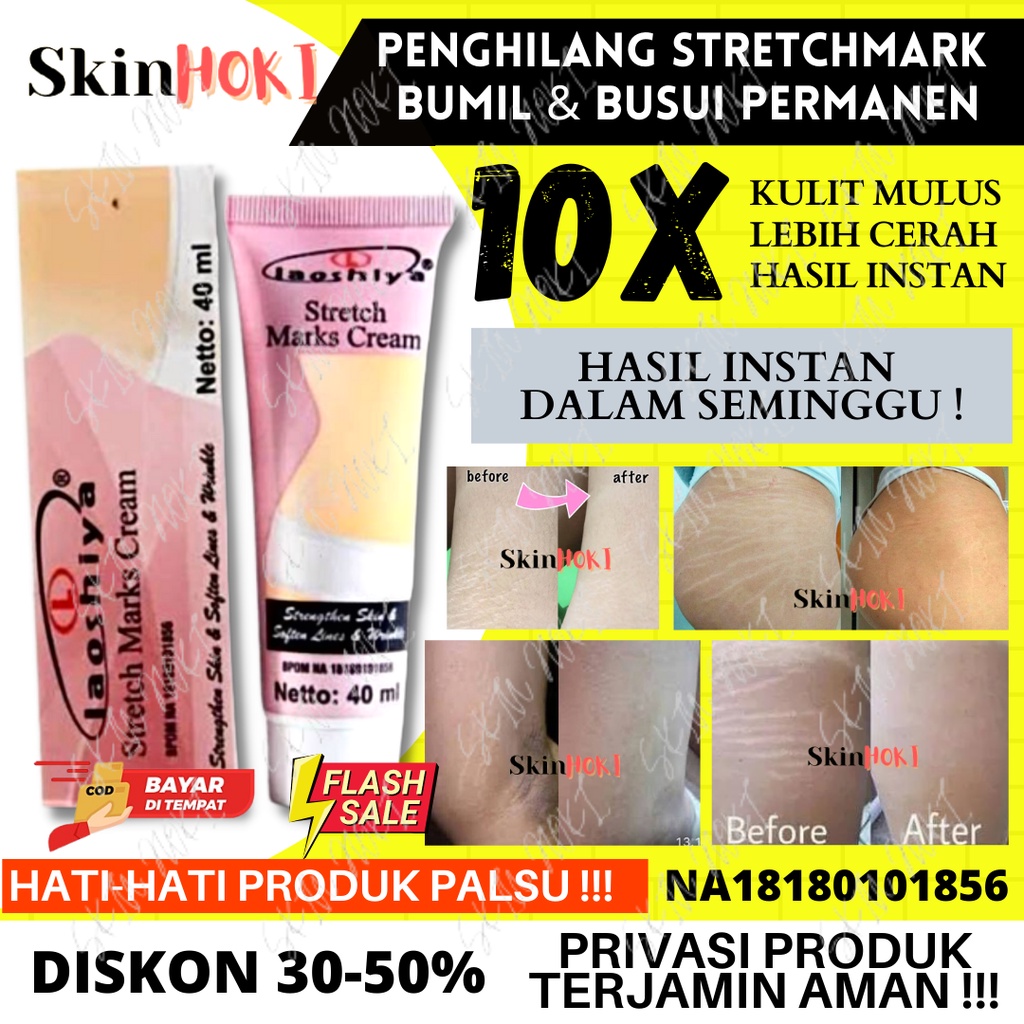 PENGHILANG STRECHMARK LAOSHIYA STRETCH MARKS CREAM ORIGINAL BPOM