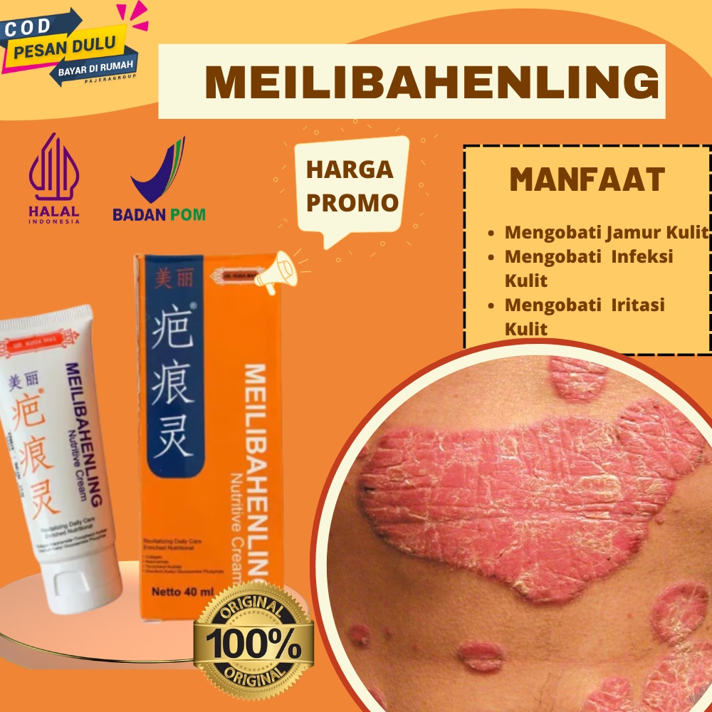 Salep  Ampuh Mengobati Jamur Kulit,Iritasi Pada Kulit,Infeski Kulit,Salep Meilibahenling Atasi Masal