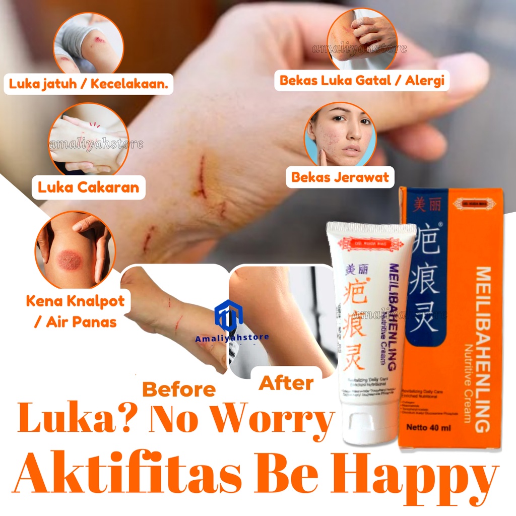 Meilibahenling Nutritive Lotion Cream Obat Penghilang Bekas Luka Diabetes Krim Salep Flek Hitam Gatal Jamur Koreng Membandel Agar Cepat Kering Untuk Anak Dan Dewasa Paling Ampuh 100% Original Bpom