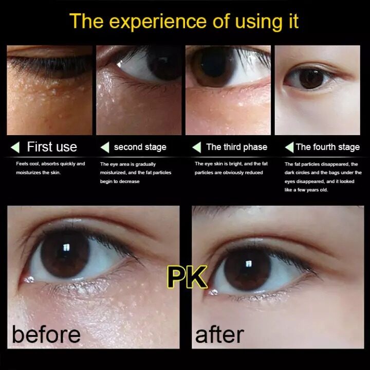 Eye Treatment Cream Eye Cream Penghilang Mata Panda Kerutan Kantung Mata Hitam 38gr Original Krim Mata Atasi Kerutan Brightening Moisturizer Glowing Moisture