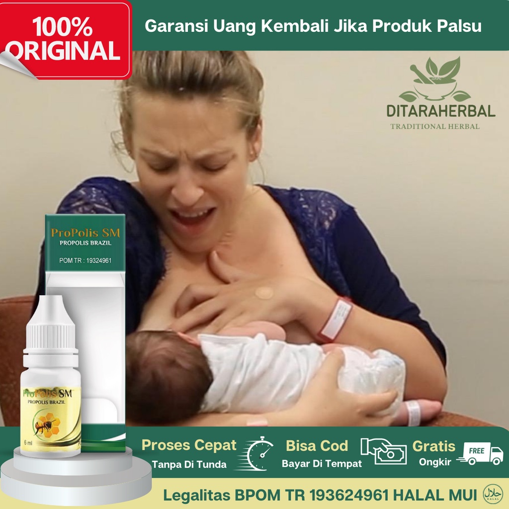 Obat Puting Lecet, Obat Tetes Puting Susu Lecet, Obat Puting Lecet Dan gatal saat Menyusui, Obat Put