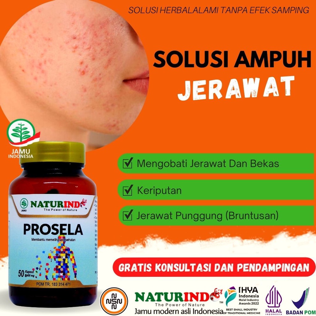 Obat jerawat gatal kulit panu penghilang bekas jerawat paling ampuh batu koreng acnes PROSELA Naturindo