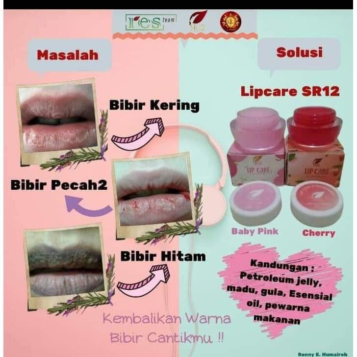 Lipcare Cherry SR12 BPOM Atasi Bibir Kering Pecah Pelembab Alami Bibir Mengembalikan Warna Alami Bibir