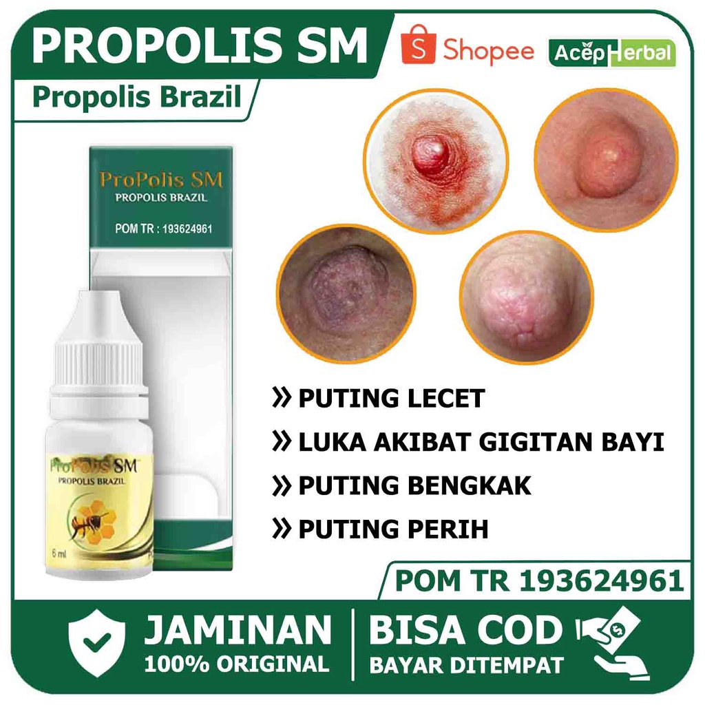 obat puting lecet puting luka akibat gigitan bayi puting susu bengkak puting perih propolis sm asli 