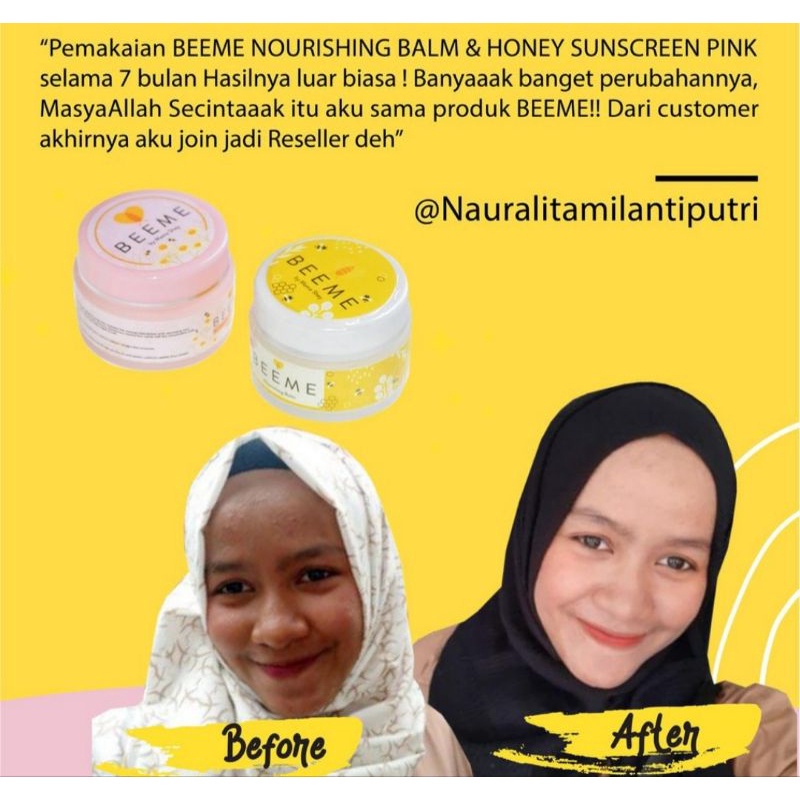 ❤️FREE EMAS❤️ Beeme Nourishing Balm | SKINCARE IBU DAN ANAK Original