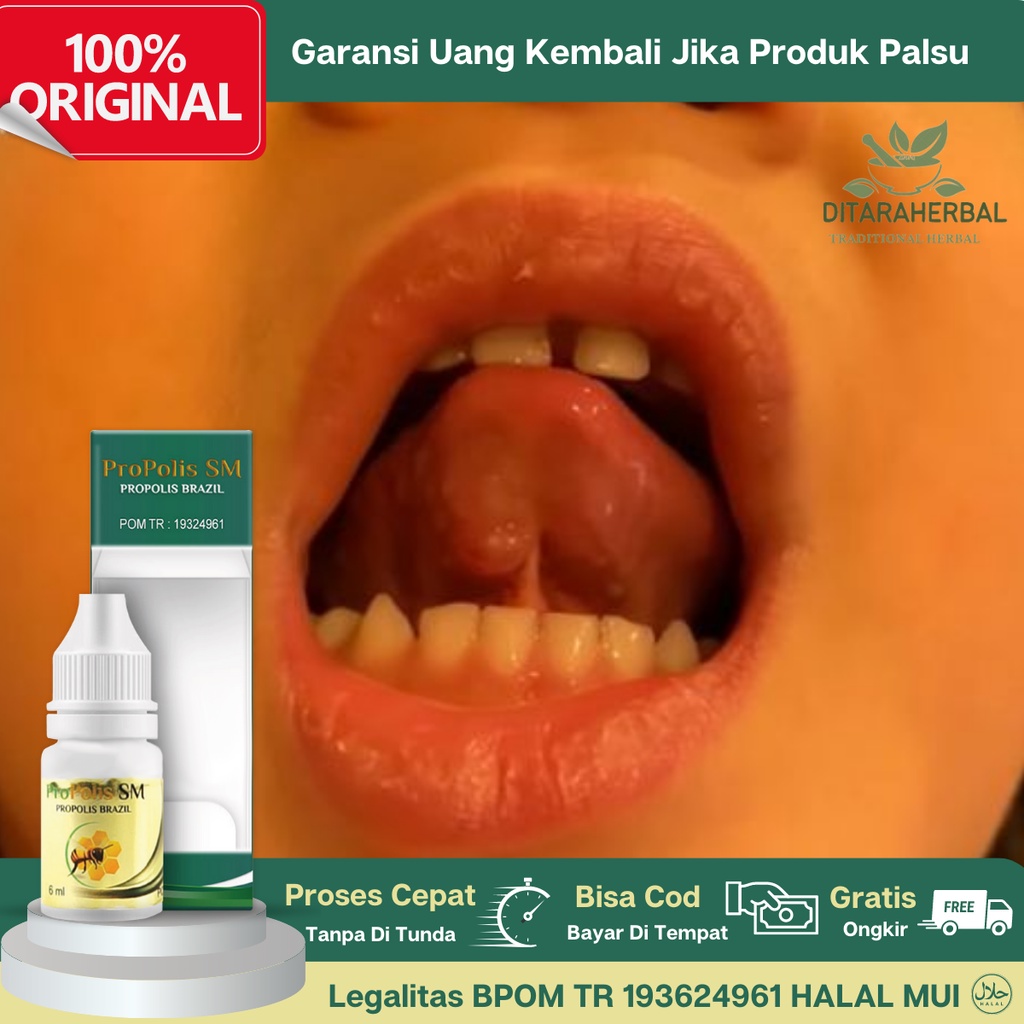 Obat Benjolan Di Bawah Lidah, Obat Penghilang Benjolan Bawah Lidah, Obat Benjolan Di Ujung Lidah, Ob