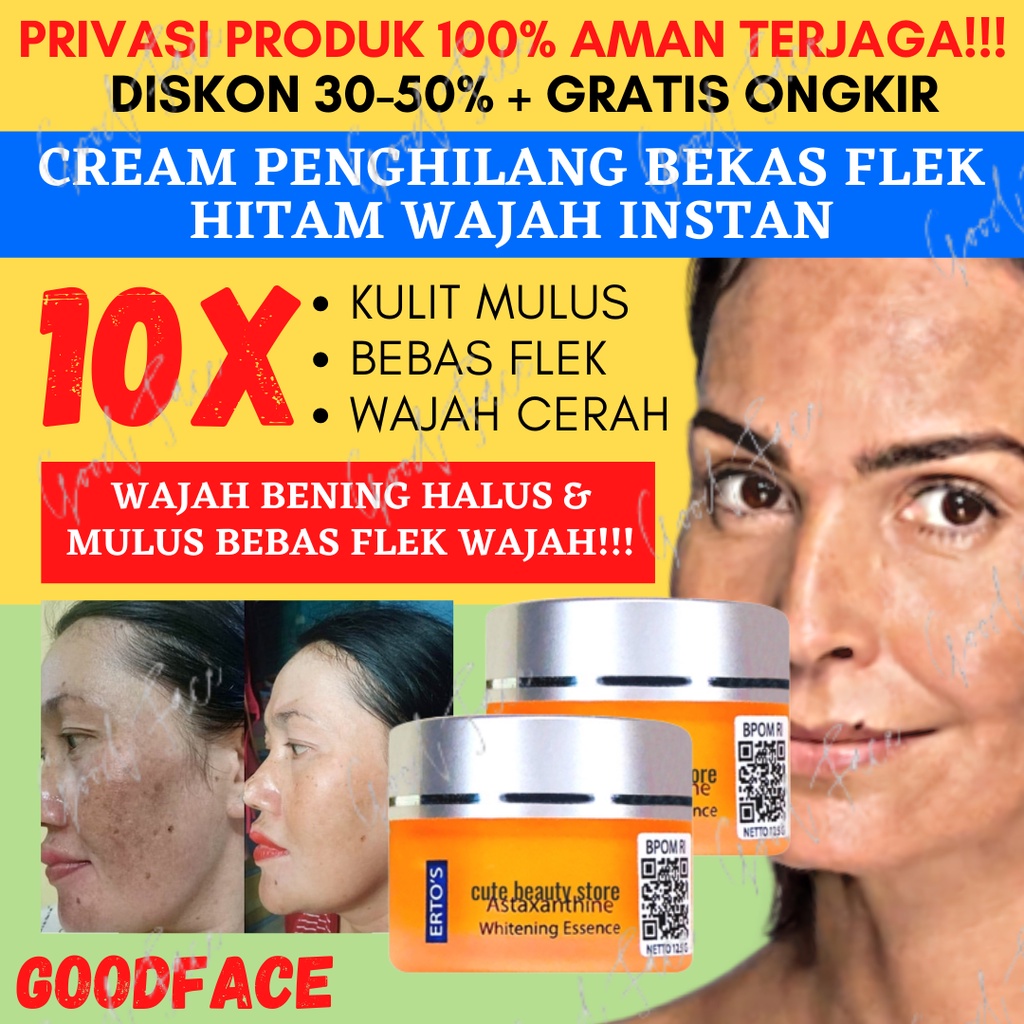 CREAM PENGHILANG FLEK HITAM ERTOS ASTAXANTHINE WHITENING ESSENCE