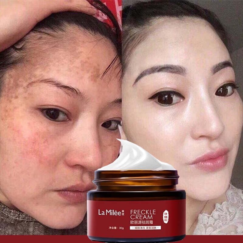 Cream Pemutih Wajah Salep Flek Hitam Membandel 30g Night Whitening Salep Flek Hitam Penghilang Flek Hitam Di Wajah Ampuh Bpom