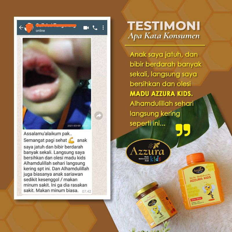 

Azzura Kids|madu multivitamin anak sehat cerdas pintar Penambah nafsu makan anak