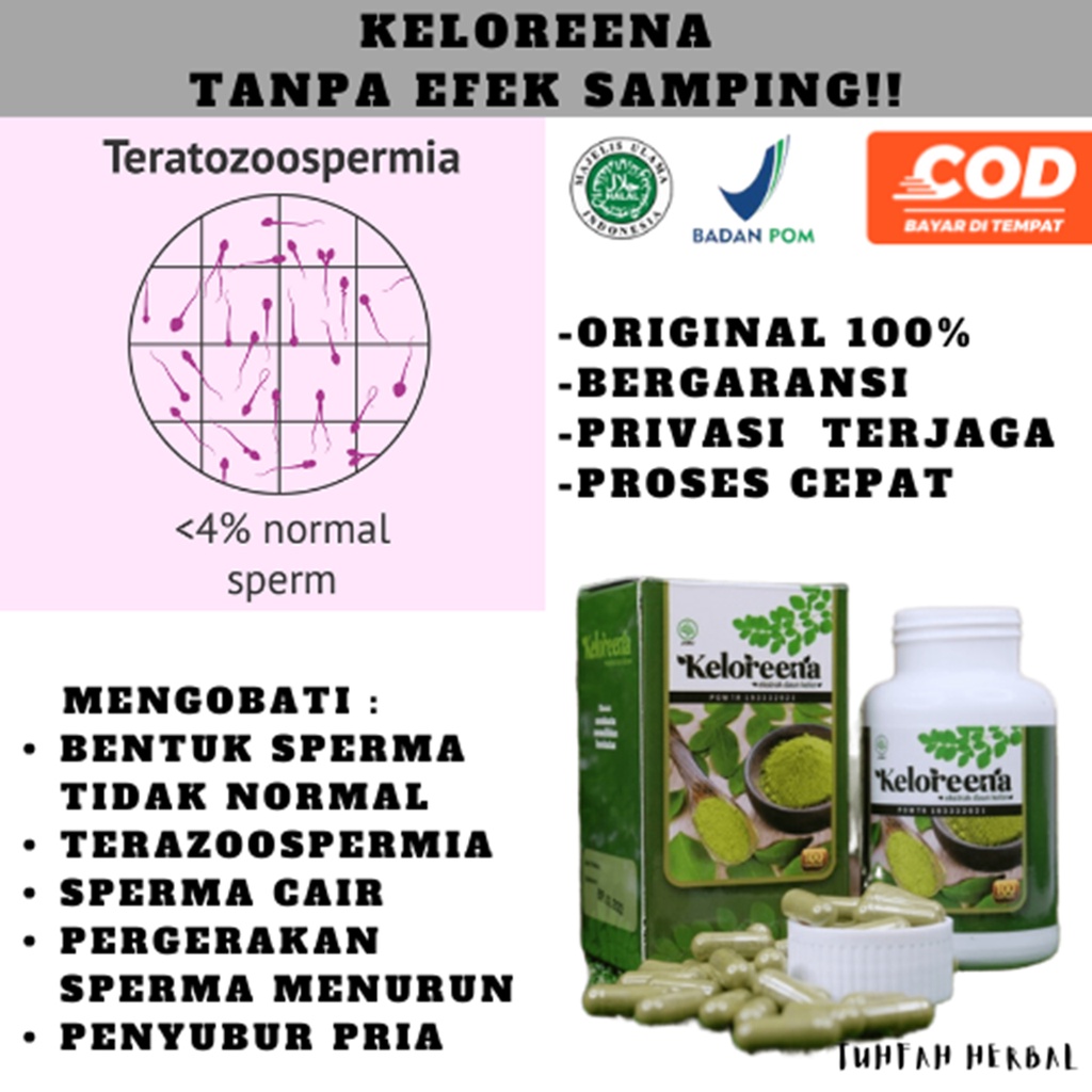 Obat Sperma Tidak Normal Teratozoospermia, Obat Sperma Encer, Penyubur Pria, Pergerakan sperma menur