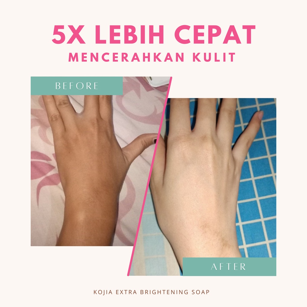 Kojia - Extra Brightening Soap | Sabun Pencerah Pemutih Badan Wajah Permanen Ampuh BPOM by rempahgadis