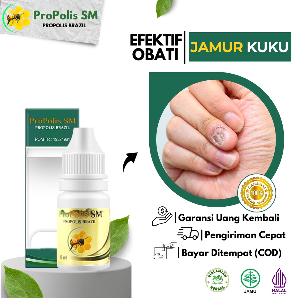 Obat Jamur Kuku - Cantengan Propolis SM Original BPOM