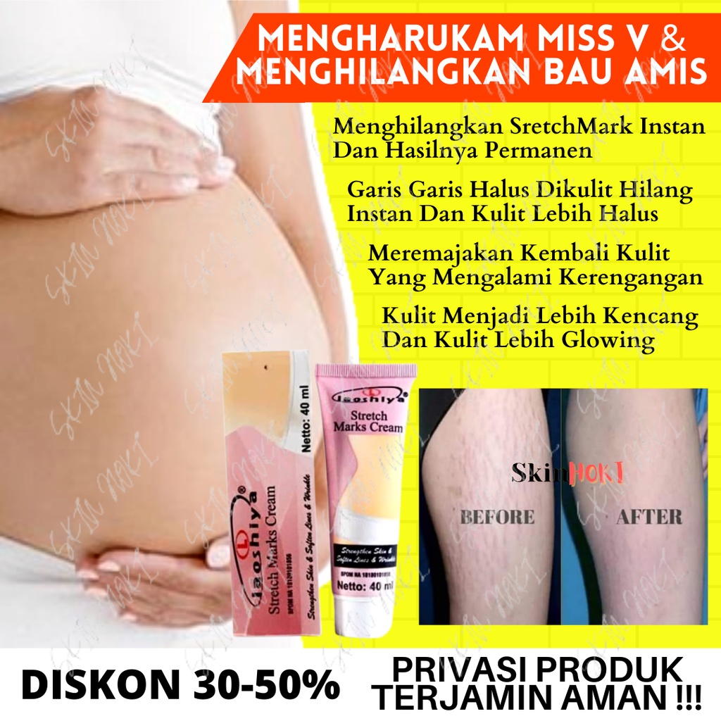 PENGHILANG STRECHMARK LAOSHIYA STRETCH MARKS CREAM ORIGINAL BPOM