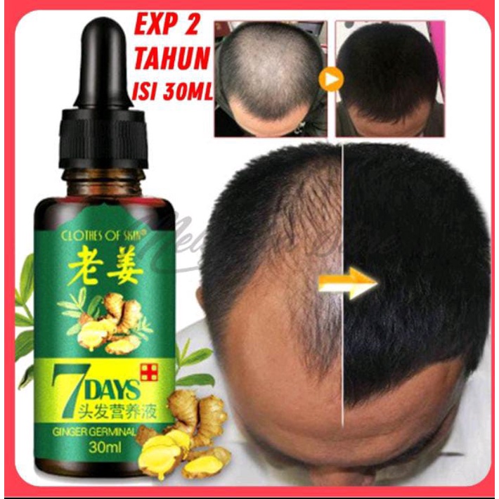 ⭐️⭐️BIG SALE⭐️ ⭐️ORIGINAL7 Days Clothes Of Skin Ginger Germinal Oil Minyak Penumbuh Rambut ORI