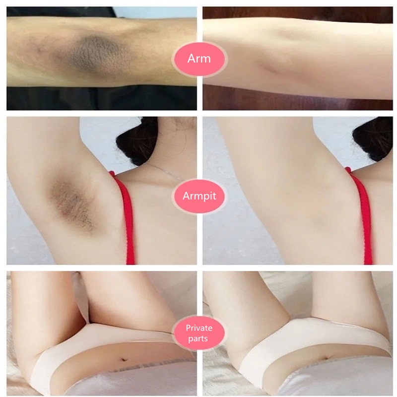 Cream pemutih ketiak krim pemutih cream pencerah ketiak dan selangkangan 50gr Body Whitening Underarm Whitening Cream Mencerahkan Pemutih Kulit Bagian Pribadi