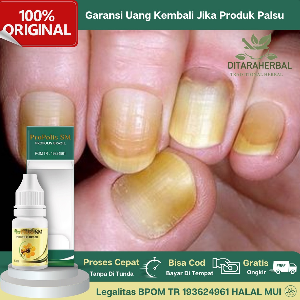 Obat Kuku Rusak, Obat Jamur Kuku, Obat Kuku Bau, Obat Busuk, Obat Kuku Hitam, Obat Kuku Bernanah, Ob