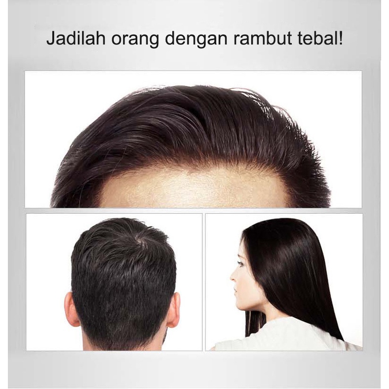 Ginge Hair Growth Essence HAIR TREATMENT Penumbuh Pemanjang Esensi Semprotan jahe 30ml Botak Rontok germinal rambut Perawatan Anti-ketombe pertumbuhan rambut cepat