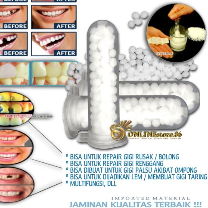 ➾ TEMPTOOTH TEMPORARY DIY TOOTH Lem Penambal Gigi Rusak Gel Gigi Buat Tambal lubang Retak Renggang b