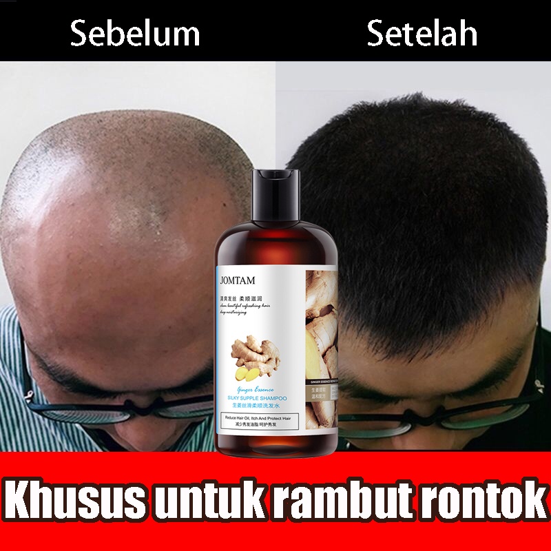 SHAMPOO RAMBUT ANTI RONTOK Hair Treatment Shampoo 300ml Anti-ketombe pertumbuhan rambut cepat Controlled Nutrition Botak Rontok germinal rambut Perawatan