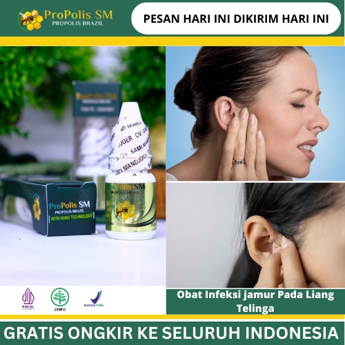 Obat Infeksi jamur Pada Liang Telinga, Obat Pembengkakan Pada Telinga, Obat Gangguan Pada Pendengara