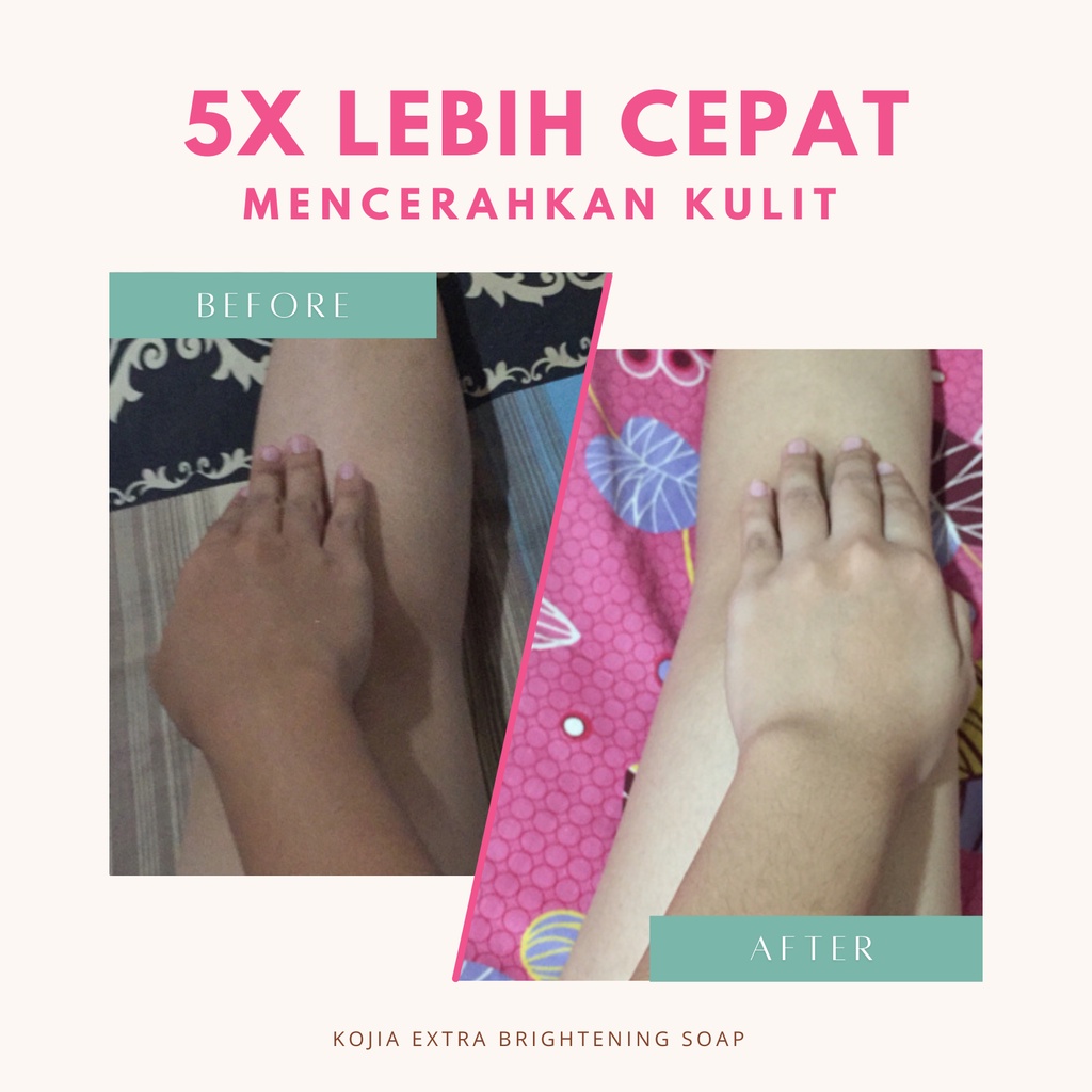 Kojia - Extra Brightening Soap | Sabun Pencerah Pemutih Badan Wajah Permanen Ampuh BPOM by rempahgadis