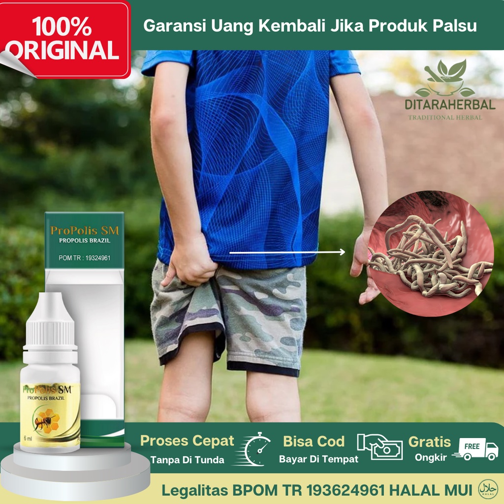 Obat Cacing Kremi Pada Anak, Obat Infeksi Cacing Kremi, Obat Tetes Cacing Kremi, Obat Gatal Anus Cac