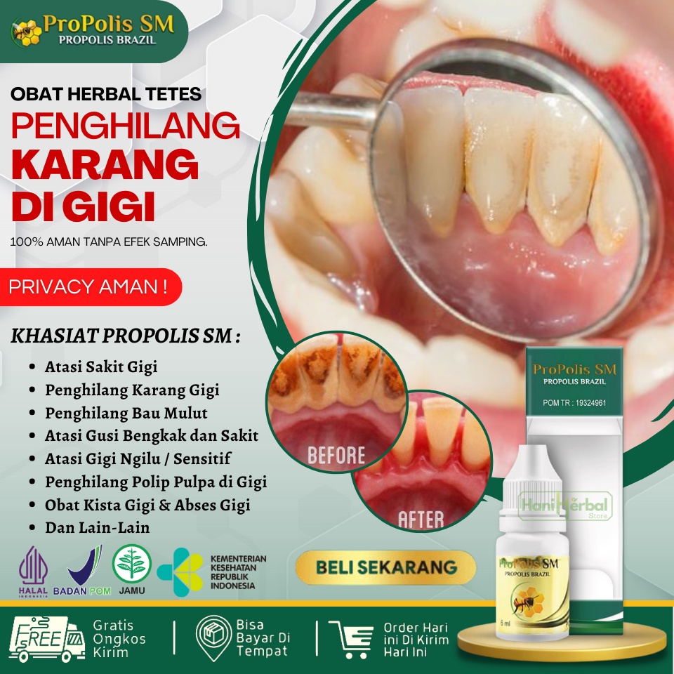 Propolis SM Obat Alami Perontok Karang Gigi, Penghilang Karang di Gigi Anak & Dewasa, Penghilang Pla