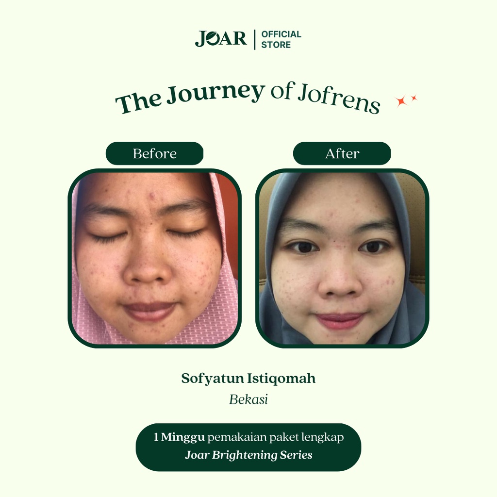 Joar Skincare [2 Pcs] Series Brightening (Soap Bar/Sabun, Serum, Day Cream, Night Cream &amp; Face mist)