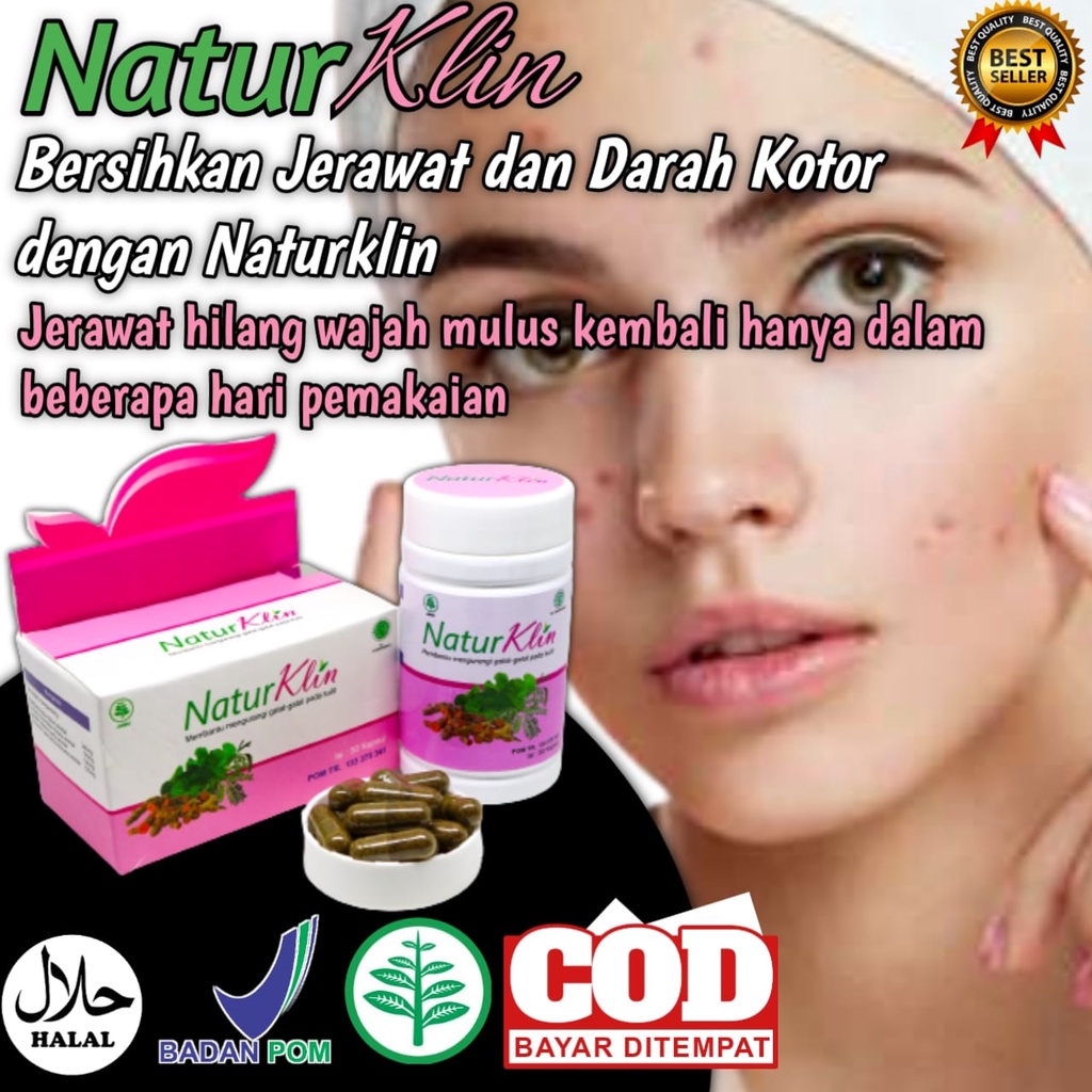 Obat Jerawat ampuh Dan Bekas Jerawat BPOM HALAL MUI Naturklin isi 50 kapsul Herbal Bpom Aman di guna