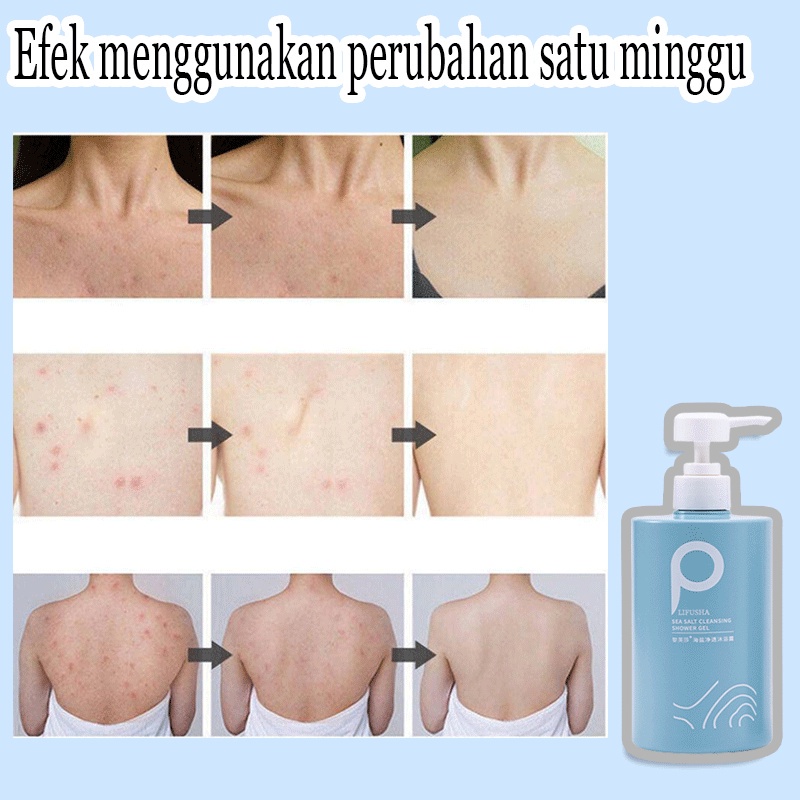 Sabun badan jerawat sabun mandi pemutih sabun mandi 500gr Kembali Jerawat Shower Gel Whitening Antipruritic Natural Sea Salt Tungau Kontrol Minyak Kontrol Sabun Mandi