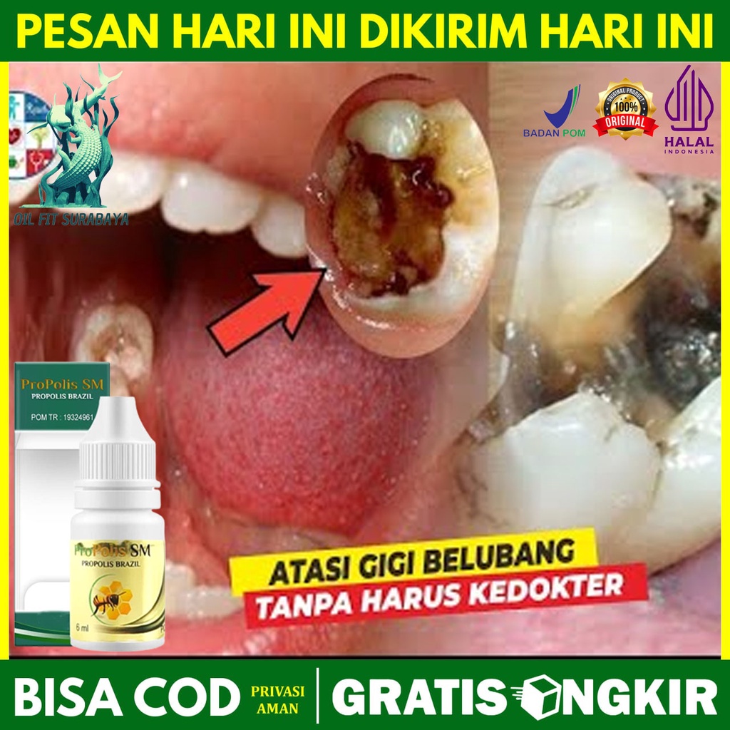 Pembasmi Ulat Gigi Menghilangkan Ulat di Gigi Penguaran Ulat Gigi Perontok Akar Gigi Berlubang Caira