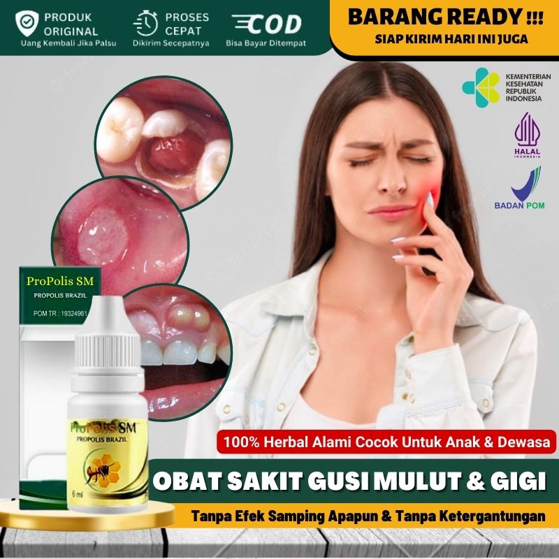 Obat Tetes Pengempis Polip Gigi Pada Anak & Dewasa, Obat Tumbuh Daging di Gigi Berlubang, Polip Gigi